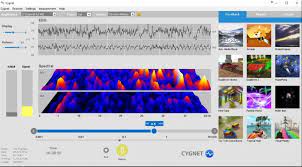 Le Neurofeedback, quelles sont les 3 méthodes actuellement disponibles en France ?